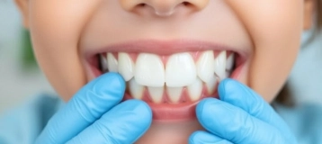 Understanding Rare Pediatric Dental Conditions and Their Treatments