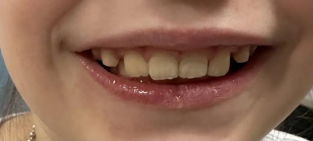 Esthetic Dentistry Pittsburgh