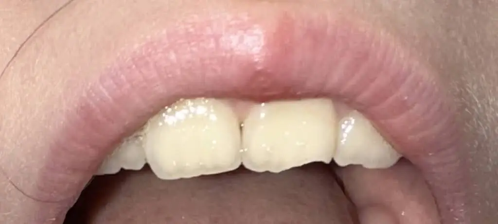 Esthetic Dentistry Pittsburgh
