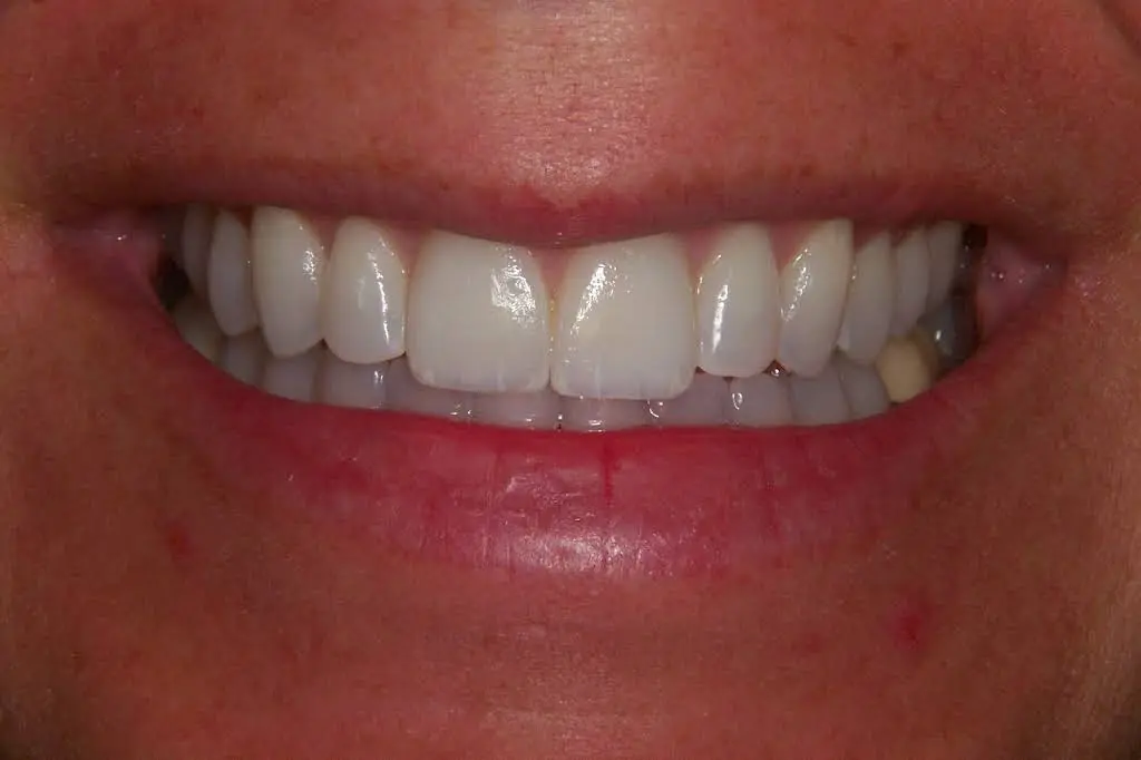 Esthetic Dentistry Pittsburgh