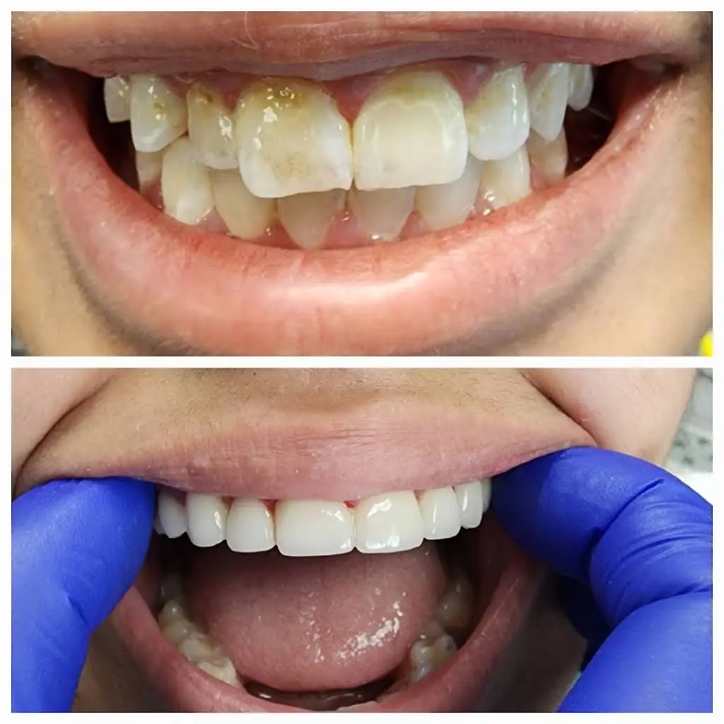 Excel Dental