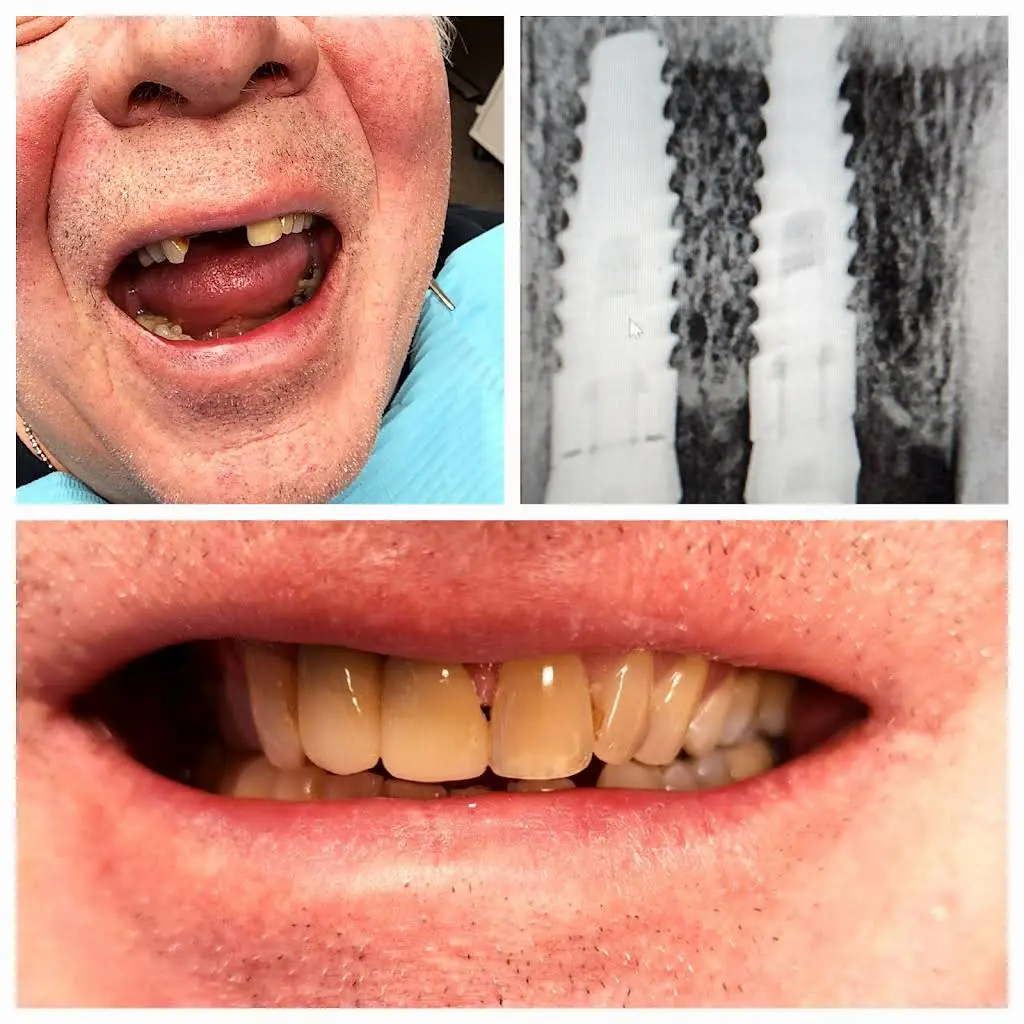 Excel Dental