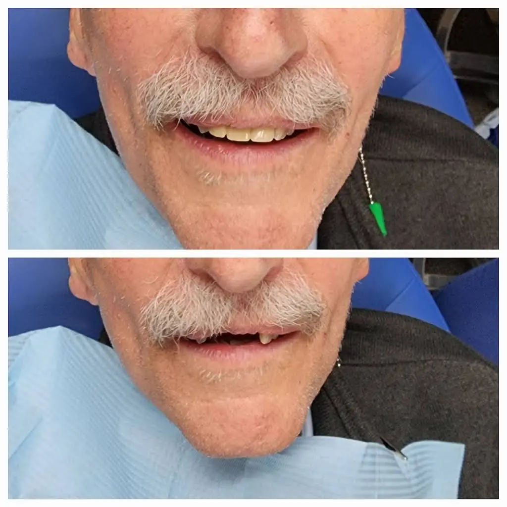 Excel Dental