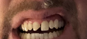 Louis J. Corrado, DDS