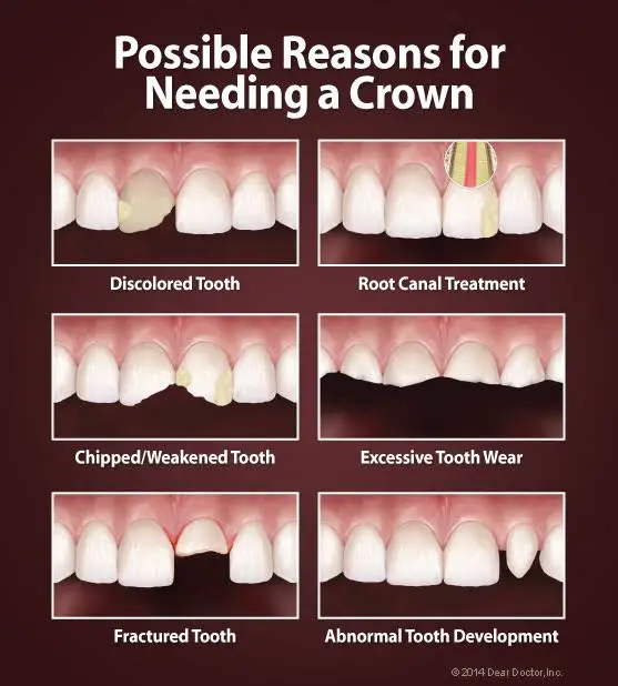 A.I.R. Dentalplex