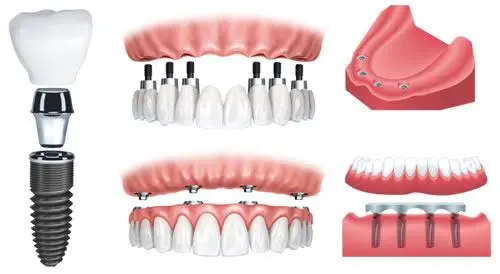 A.I.R. Dentalplex