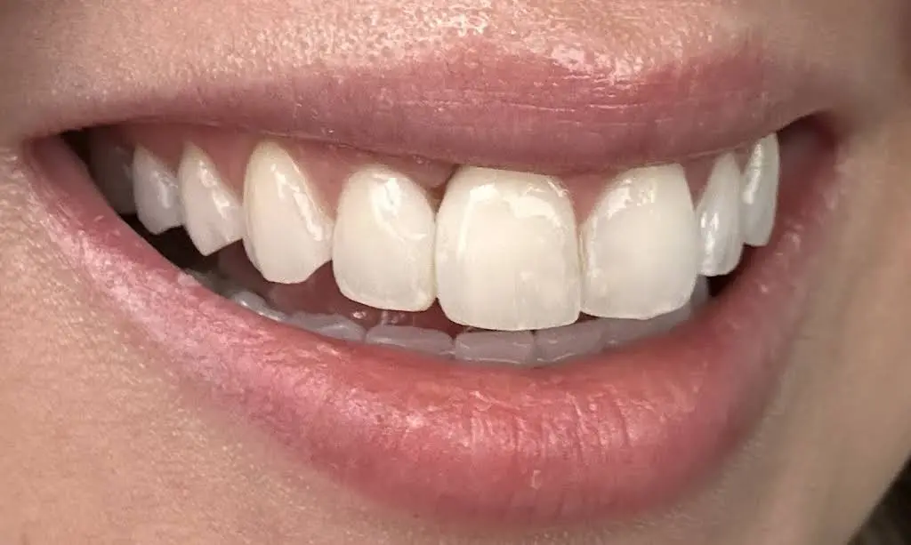 Esthetic Dentistry Pittsburgh
