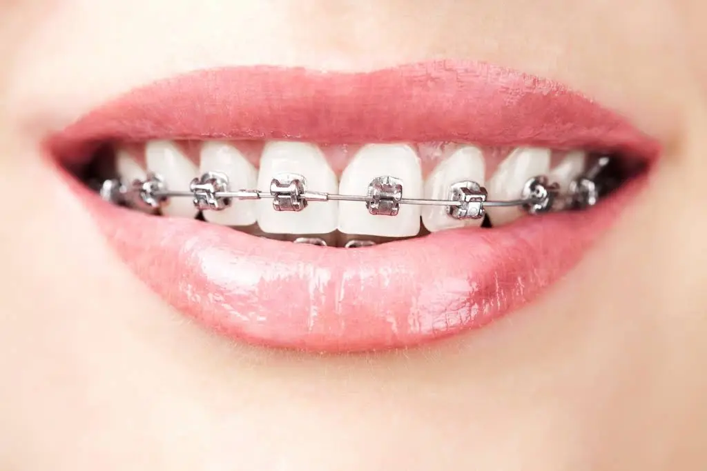 Sencak Orthodontics