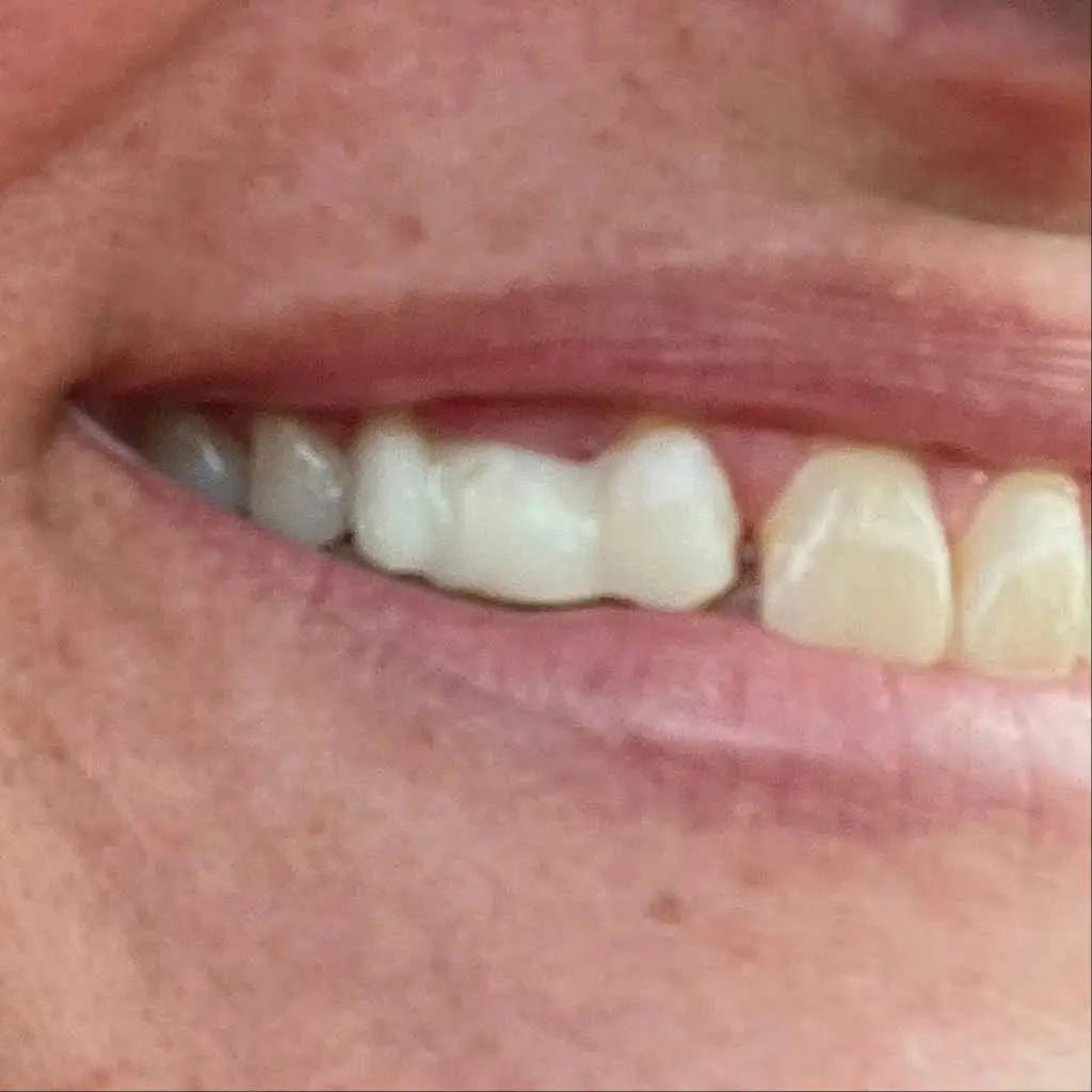 1st Advantage Dental - Bethlehem