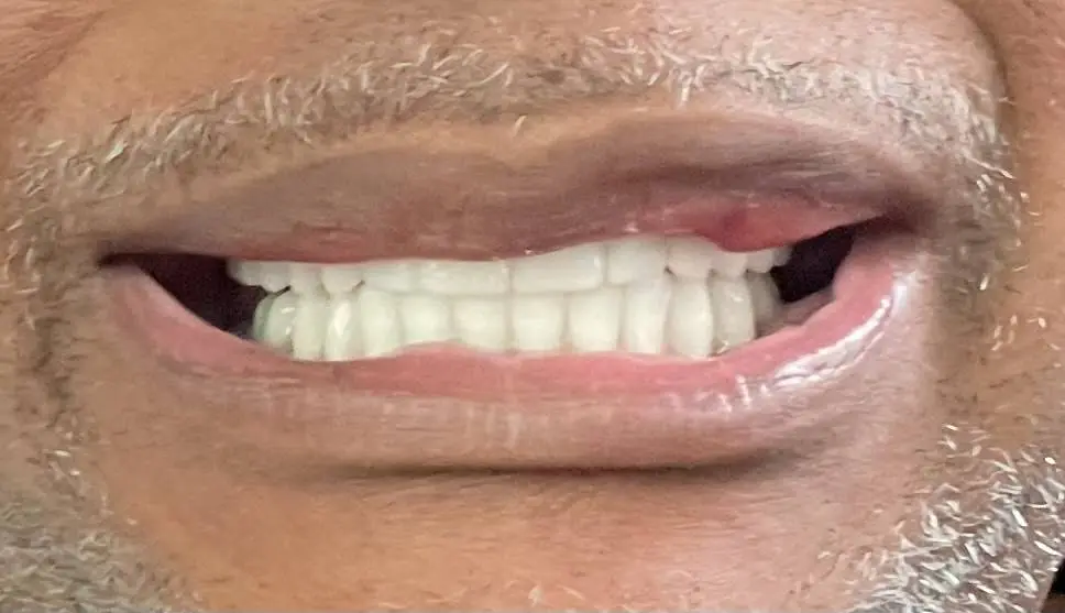 ClearChoice Dental Implant Center