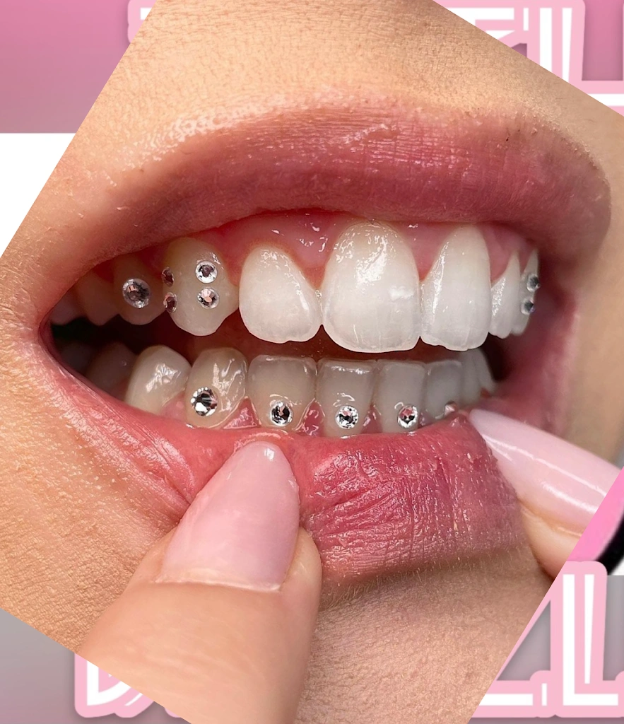 Teeth Dazzle