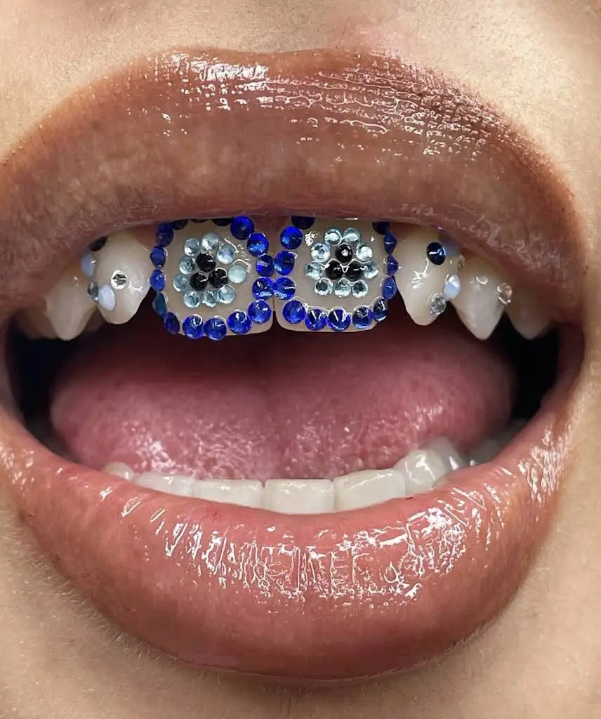 Teeth Dazzle