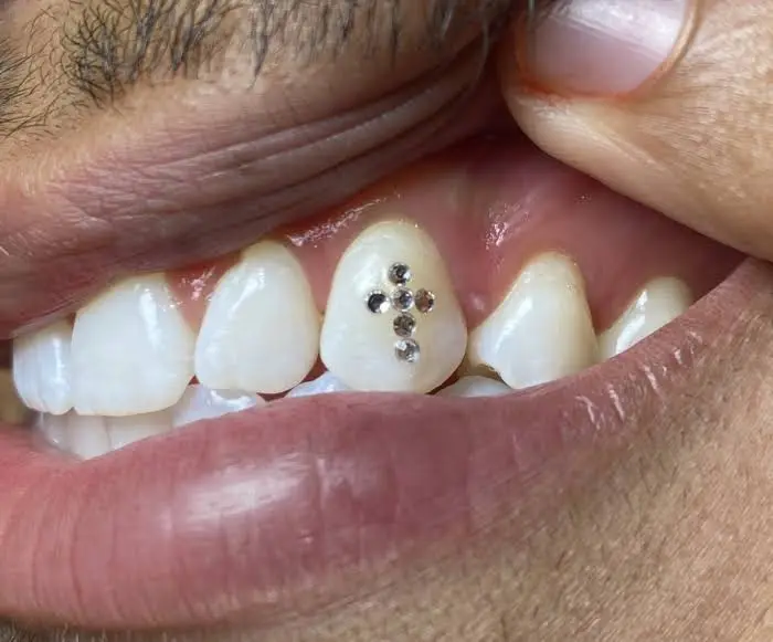 Teeth Dazzle