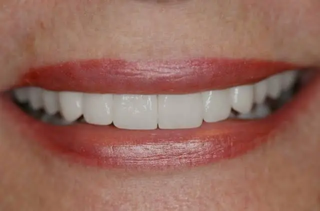 West Vinings Dental Aesthetics