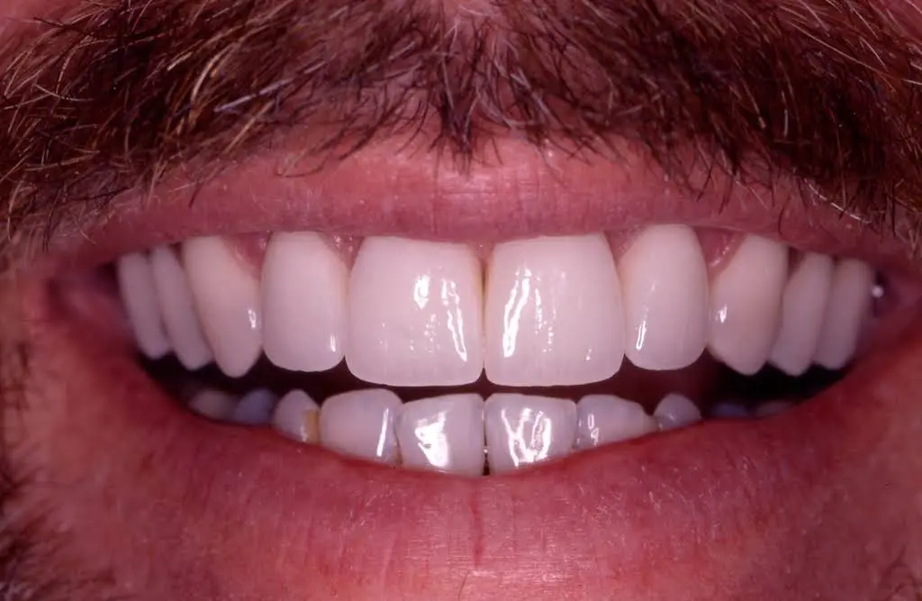 West Vinings Dental Aesthetics