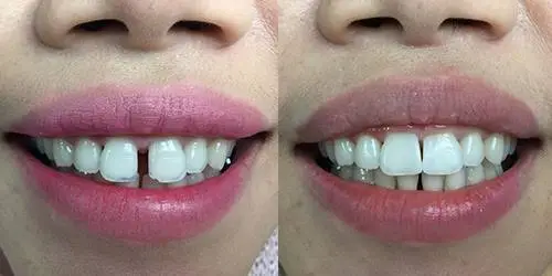 Hiram Dental Smiles