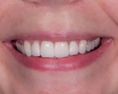 JLM Dental Studios