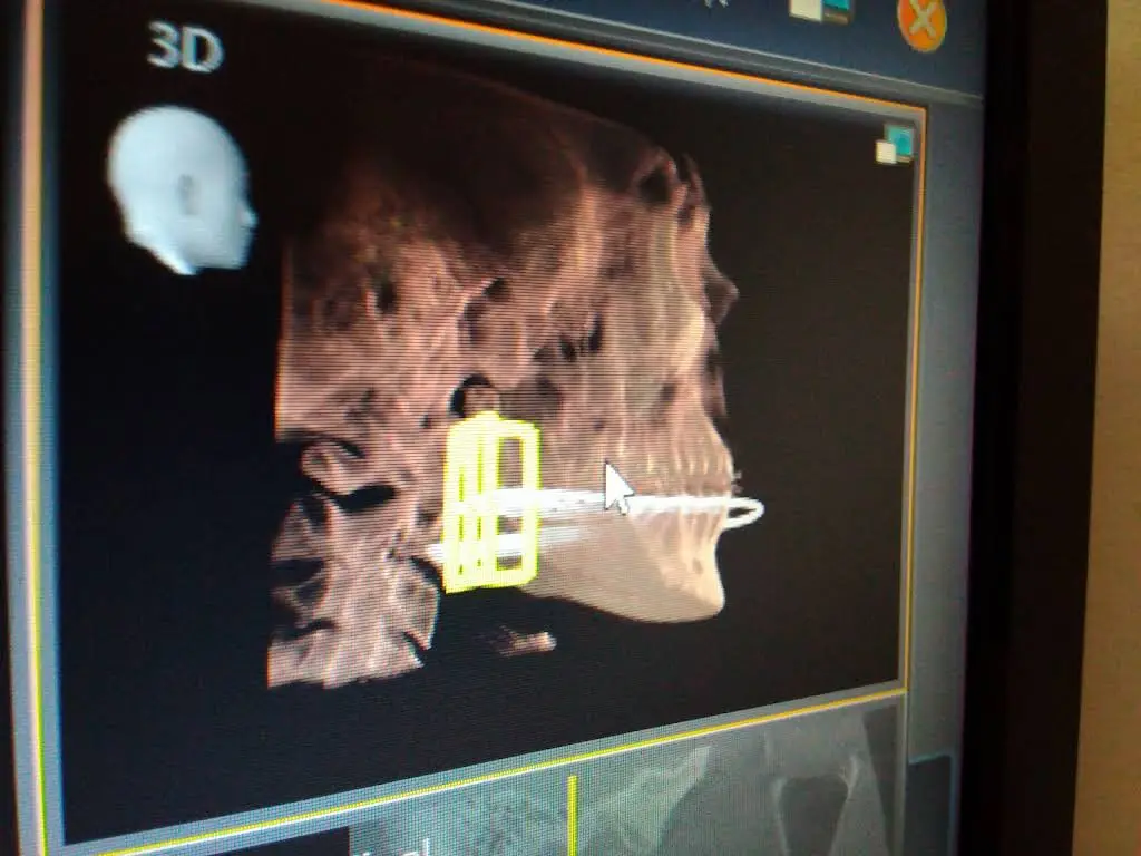 Precision Oral Surgery