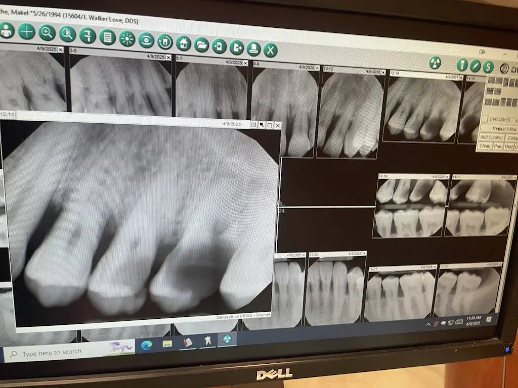 Collier Hills Dental