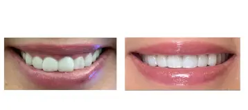 Buckhead Dental Center