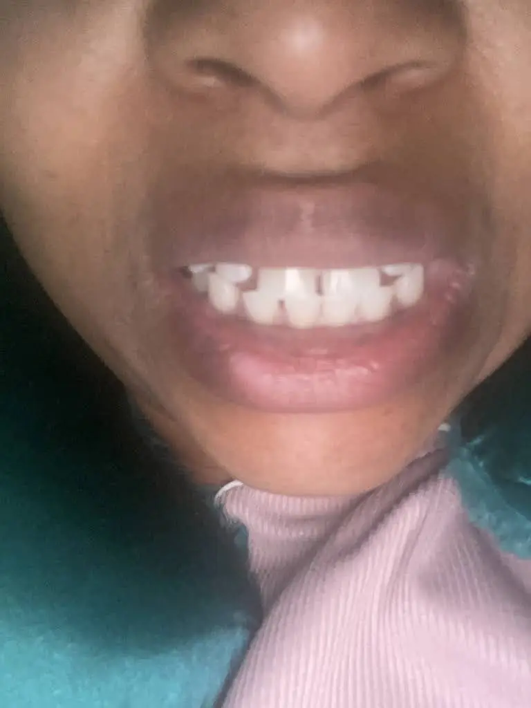 Just Brush My Teeth