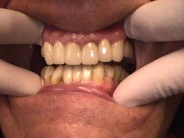 Rotterdam Family Dentistry Anthony Bogdan DDS