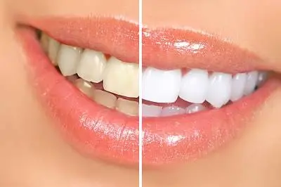 Padula Family Dentistry