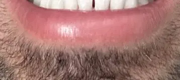 PITTSBURGH PERIODONTAL ASSOCIATES