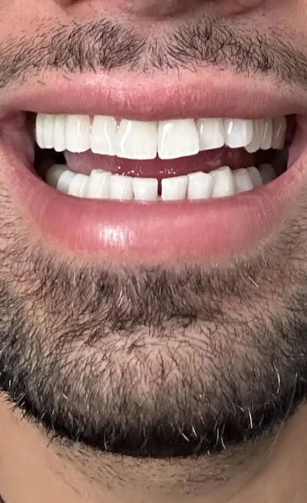 PITTSBURGH PERIODONTAL ASSOCIATES