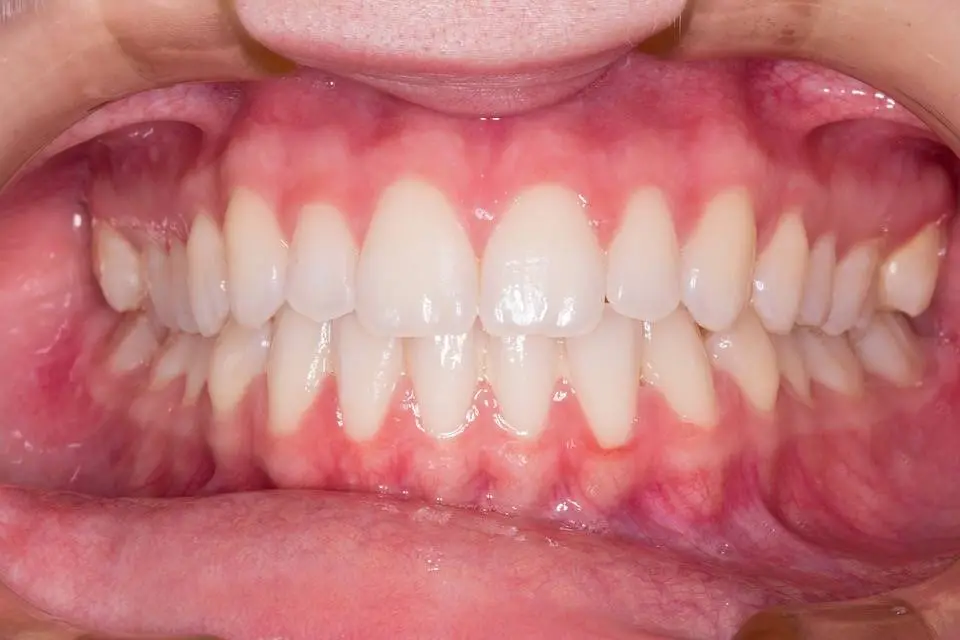 Kabani Dental