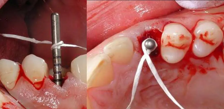 Kabani Dental