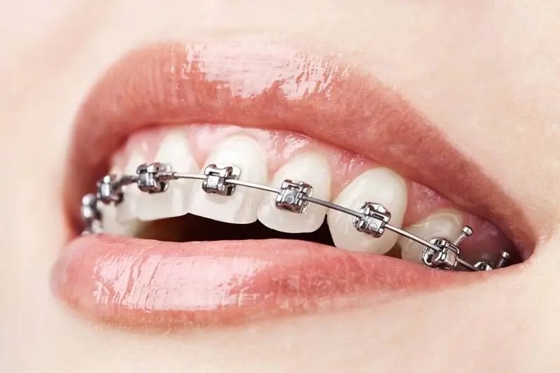 Buckhead Orthodontics