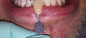 Promenade Dental Care
