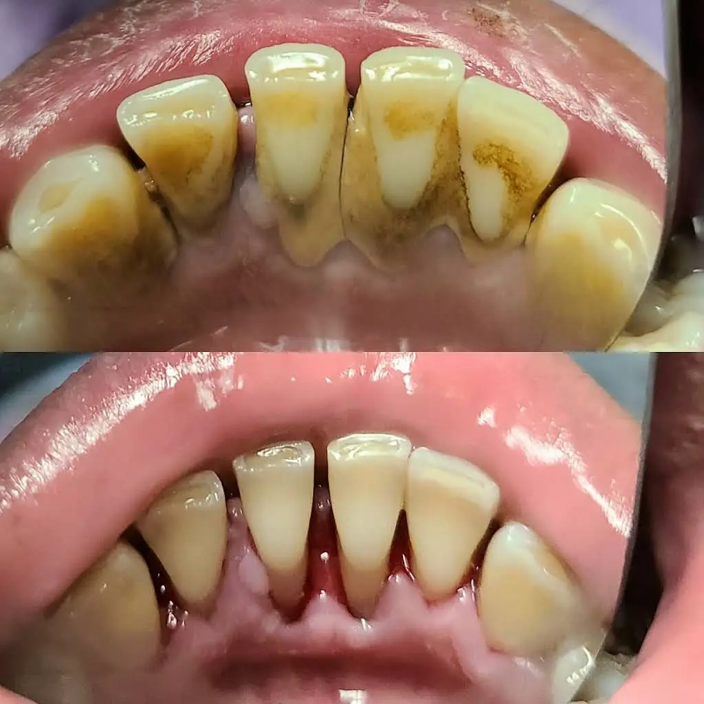 Dallas Dental Smiles