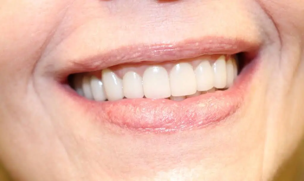 Smile! Dental Center