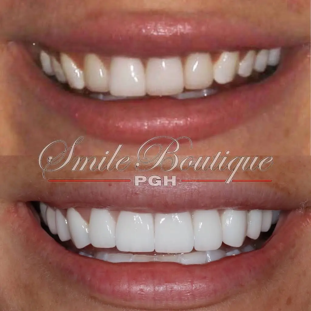 PGH Smile Boutique