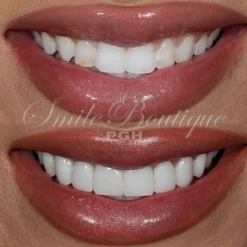 PGH Smile Boutique
