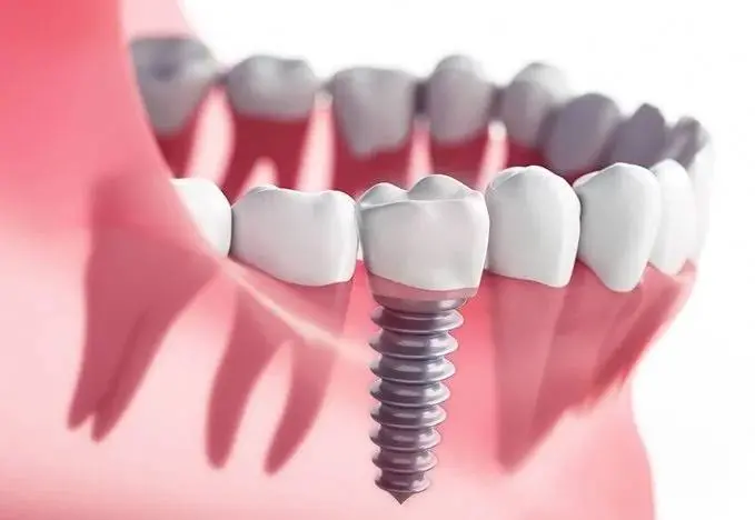 Albany Implant Clinic