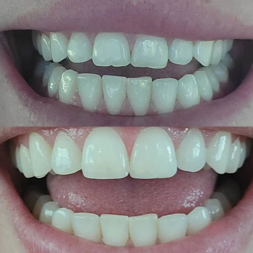 La Vita Dental Arts