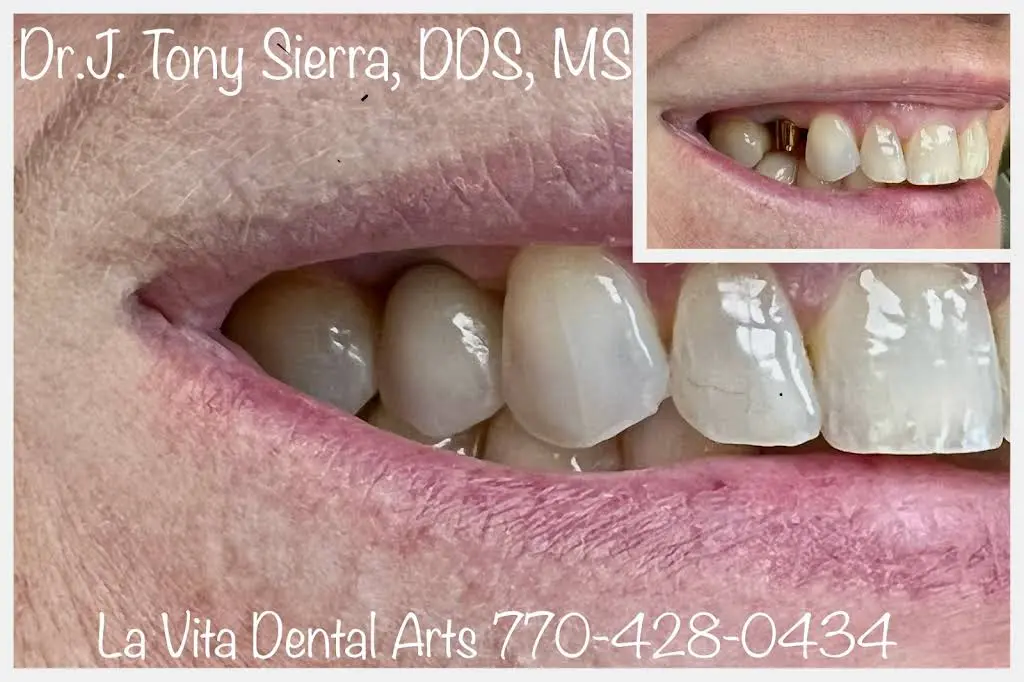 La Vita Dental Arts