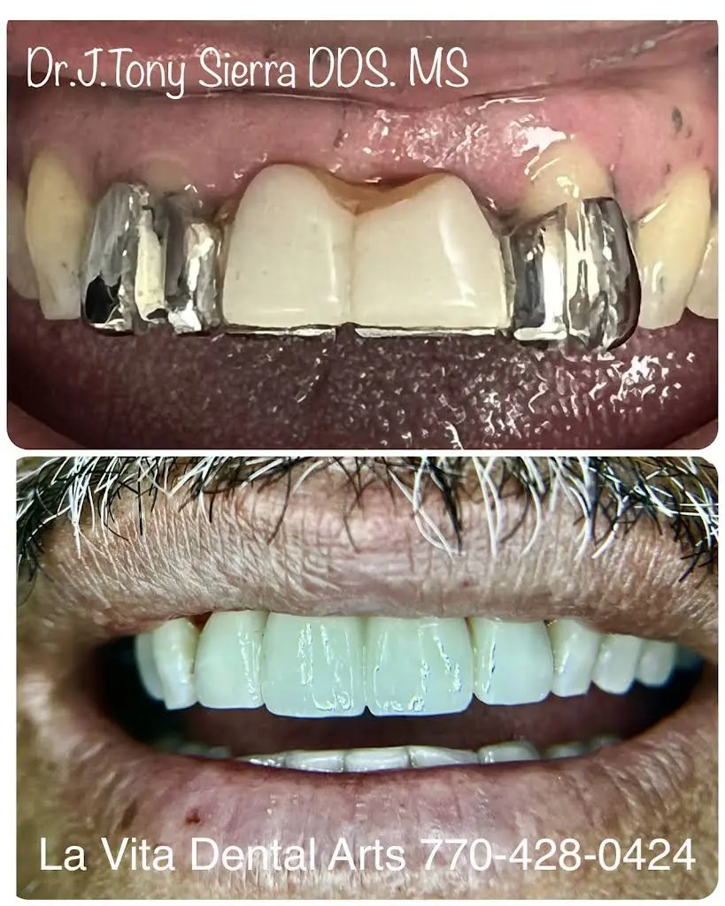 La Vita Dental Arts