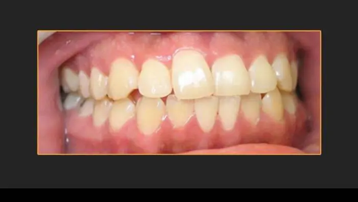 Lost Mountain Dental