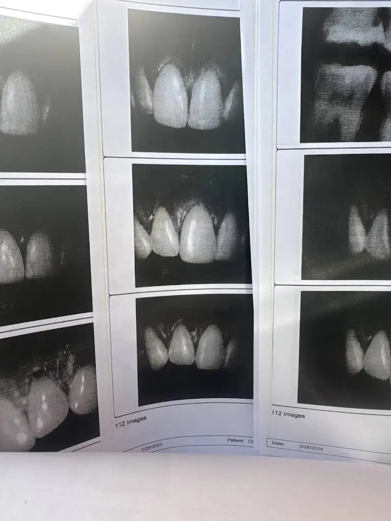 1st Advantage Dental - Glenville