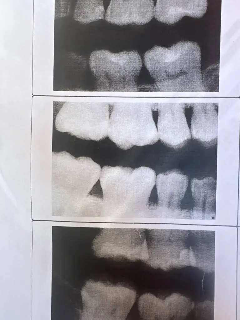 1st Advantage Dental - Glenville