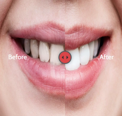 Advanced Dentistry - Groves and Associates