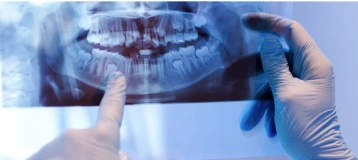 Ballston Lake Family Dental