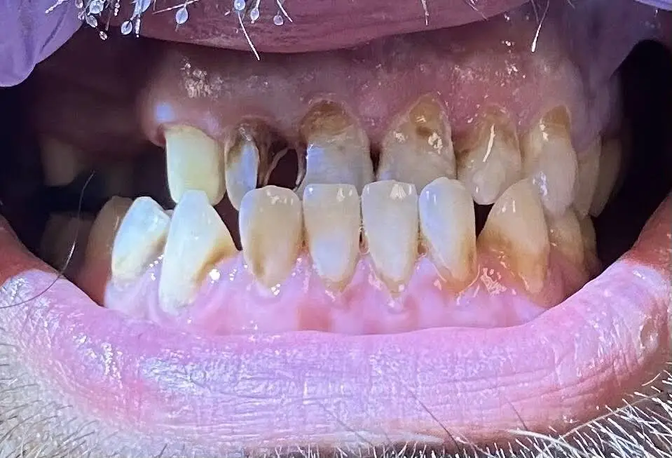 Pine Mountain Dental Care