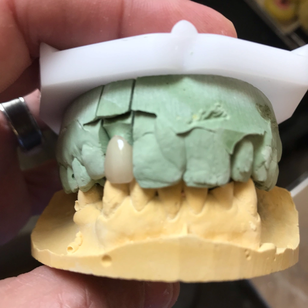 Emergency Denture Service / Emergency Denture Repair PA