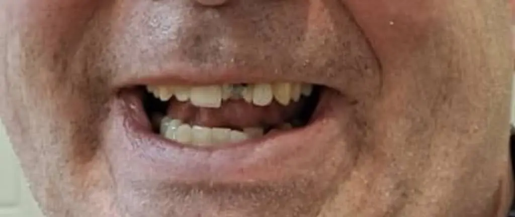 Clifton Park Dental