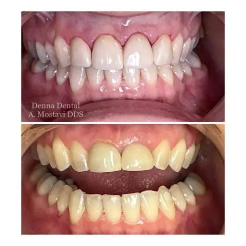 Denna Dental
